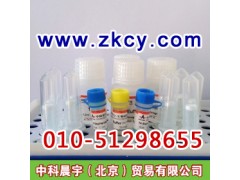 His標簽融合蛋白純化試劑盒-- 中科晨宇(北京)貿易有限公司