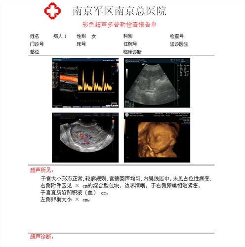 安徽膠片廠家 放射科膠片 超聲科膠片 菲力姆供-- 合肥菲力姆科技有限公司