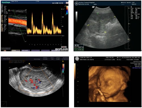 自助取片機(jī) 醫(yī)用自助取片機(jī) 醫(yī)院自助取片機(jī) 菲力姆供-- 合肥菲力姆科技有限公司